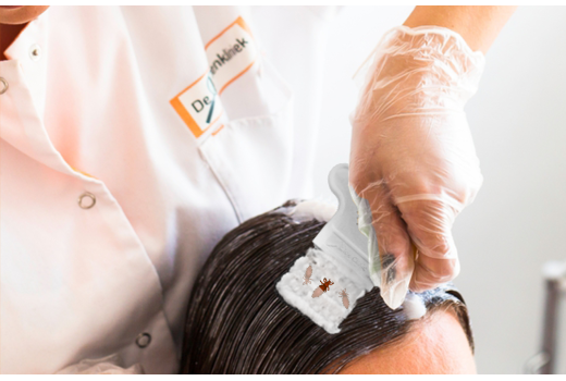 Kopfläuse auskämmen